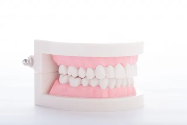義歯（入れ歯）